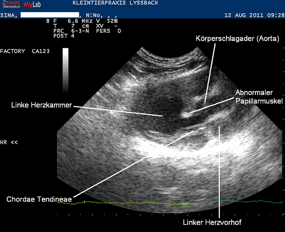 Sina Herzultraschall 1