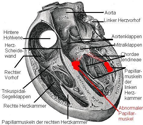 Sina Herzultraschall 2