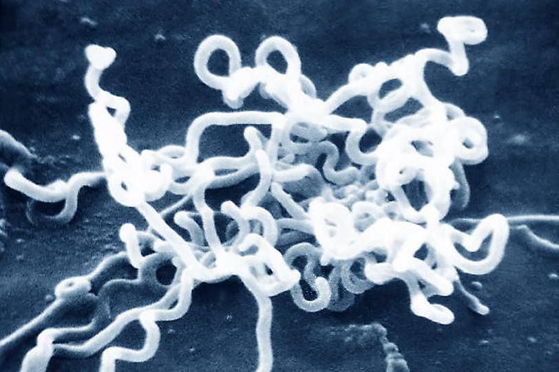 Lolly Wisschschaftliches