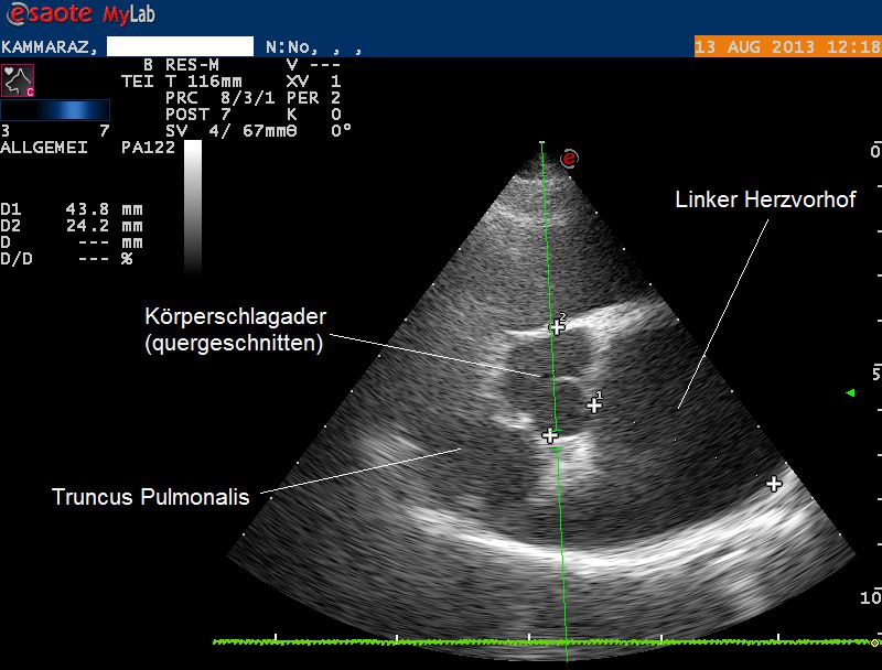 Karammaz Ultraschall 1