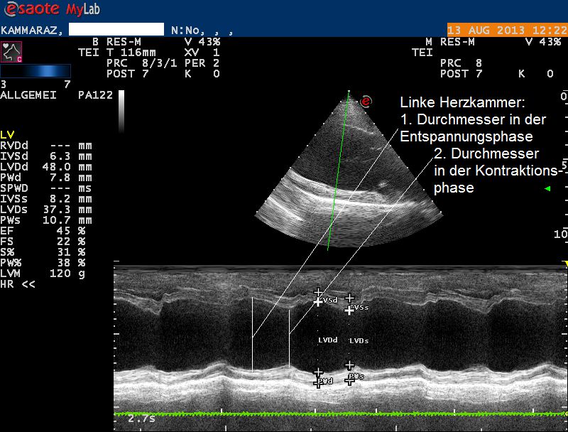 Karammaz Ultraschall 2