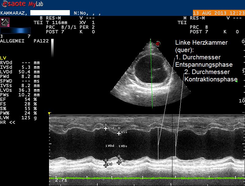 Karammaz Ultraschall 3