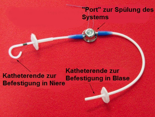 Manolo Weiterer Verlauf 1