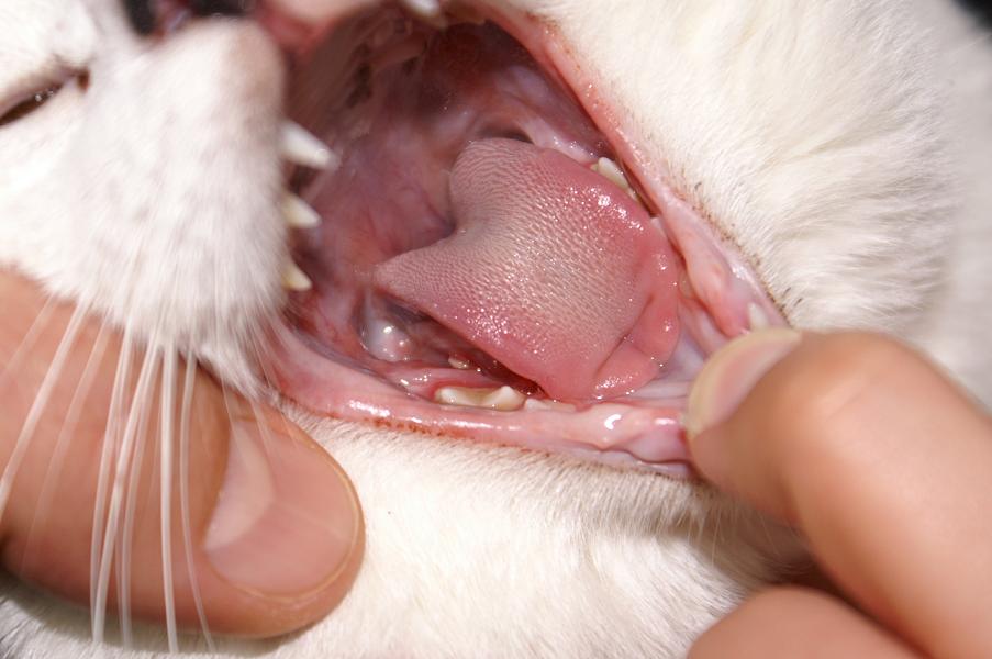 Speichelcyste (Ranula)