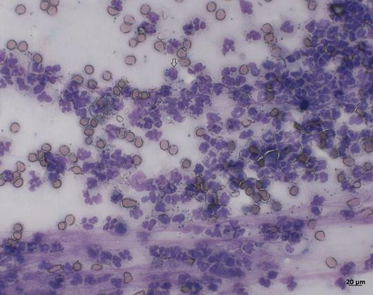 Charly Zelluntersuch 1