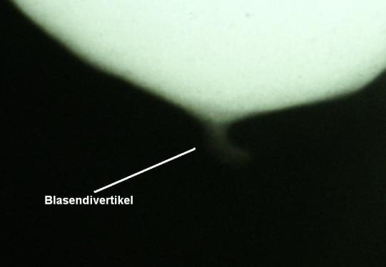 Aiko Weitere Abklärungen 2