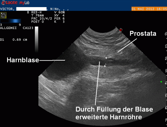 Victor Weitere Untersuchung 2