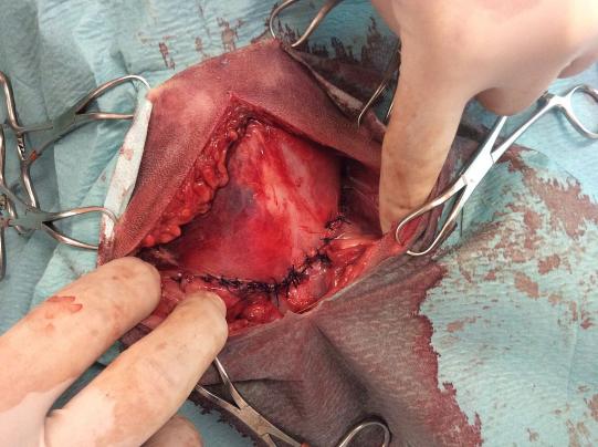 Fred Weiterer Verlauf