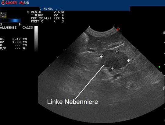 Luca Weitere Abklärungen 1