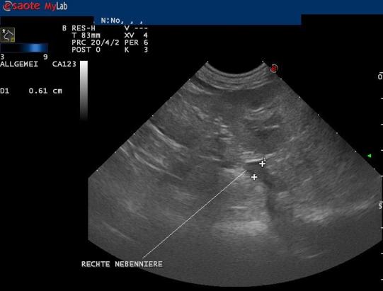 Luca Weitere Abklärungen 2