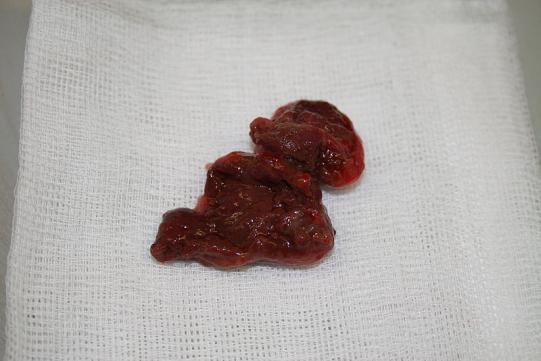 Babette Weiterer Verlauf 2