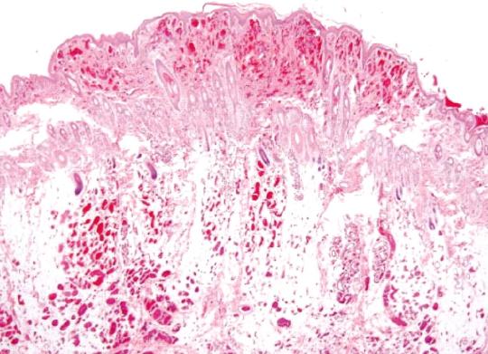 Lilly Weiterer Verlauf