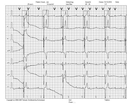 EKG und Diagnosestellung
