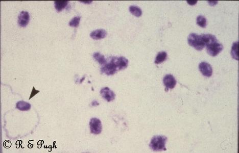 Mikroskopisches Bild: Ezephalitozoon Cuniculi (Copyright R.E. Pugh)