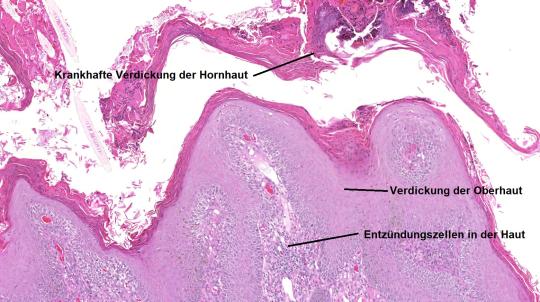 Gewebeprobe der Haut; Aufnahme: Dr. med. vet. DiplECVP P. Grest und Dr. med. vet. DiplECVP S. Kirschner-Kitz, Institut für Veterinärpathologie Universität Zürich