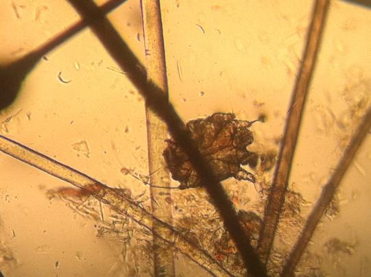 Untersuch und Diagnosestellung