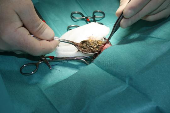 Therapie und weiterer Verlauf