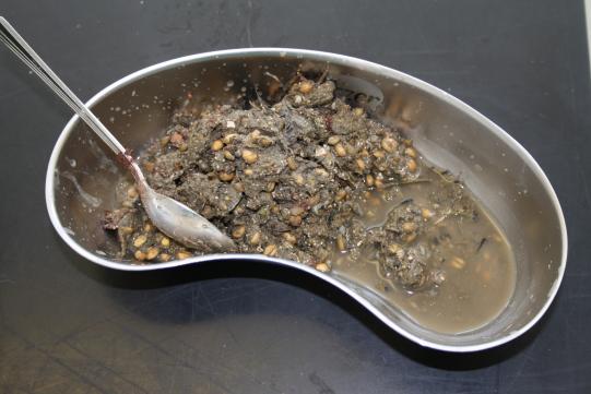 Therapie und weiterer Verlauf