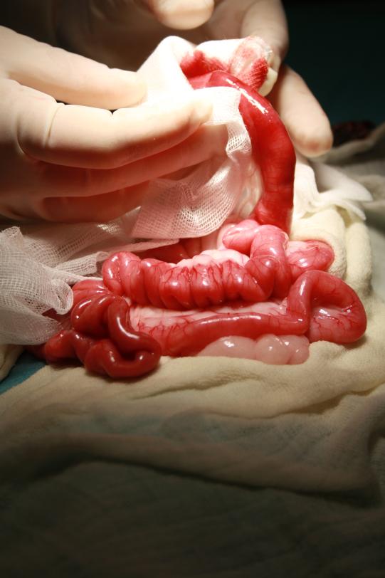 Der aufgefältelte Dünndarm ist gut erkennbar