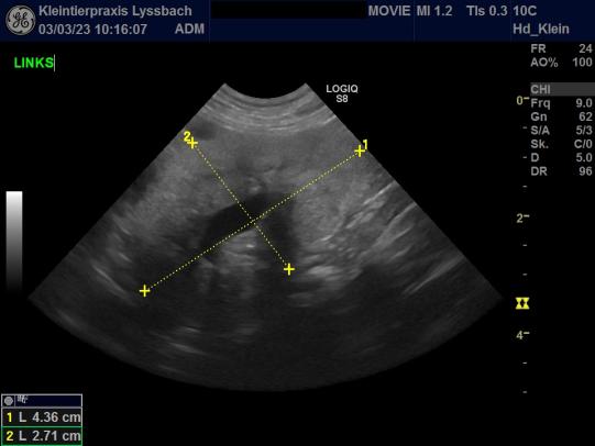 Ultraschallbild der linken Niere von Movie