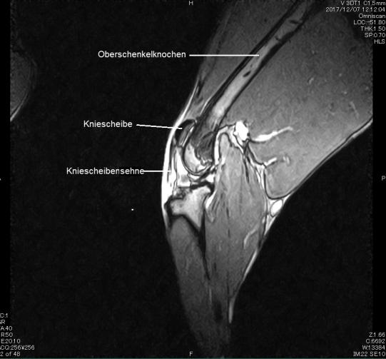 Weitere Untersuchungen: MRT