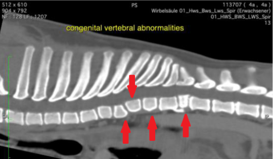 Brustwirbelsäule CT