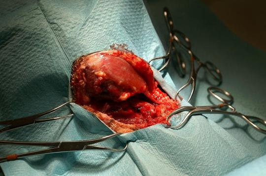 Ein ungewöhnlicher Patient