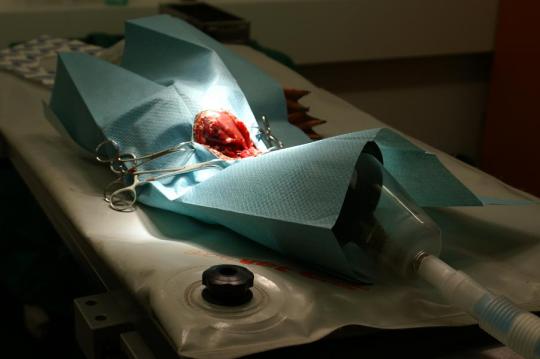 Ein ungewöhnlicher Patient