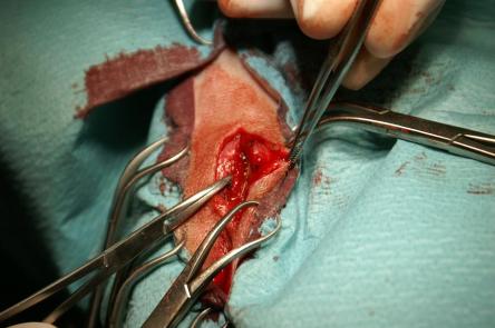 Zwischenzehenabszess/Fremdkörper