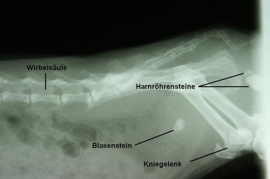 Blasen-/Harnröhrensteine