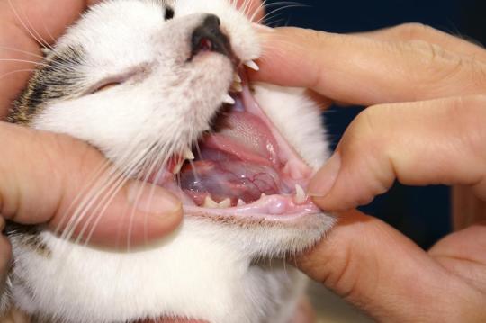 Speichelcyste (Ranula)