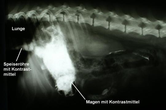 Speiseröhrenfremdkörper