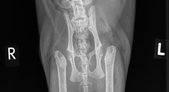 Postoperativ - die beiden Oberschenkelköpfe sind entfernt worden