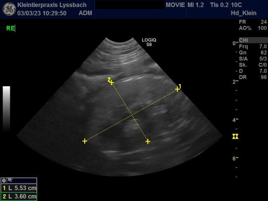 Ultraschallbild der rechten Niere von Movie