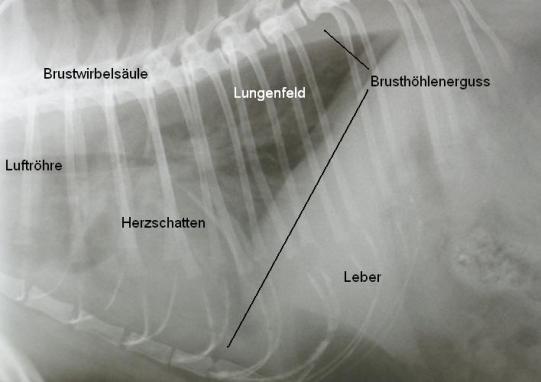 ThoraxLateral