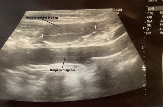 Ultraschall Hoden
