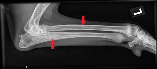 Seitenansicht Unterarm links