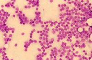 QUICHA, Cocker Spaniel, weiblich, 4 jährig