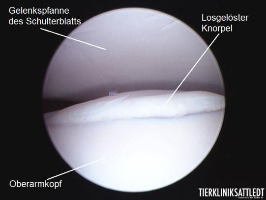 Schulter