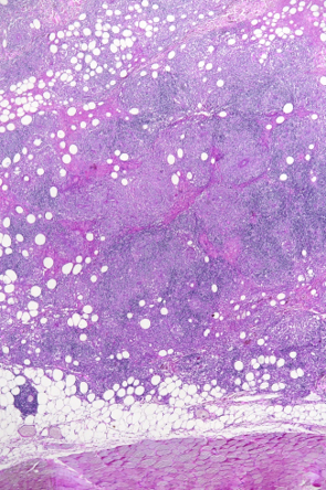 Mikroskopische Aufnahme des Gewebes - geringe Vergrösserung. Aufnahme: Dr. U. Hetzel