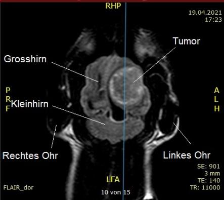 MRT-Aufnahme horizontal durch den Kopf (frontale Ebene)