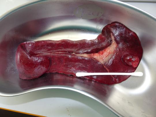 Milz von Madison - der Tumor ist am rechten Ende des Organs zu sehen