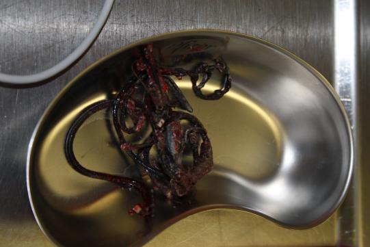 Der entfernte Fremdkörper