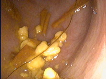 Magen mit Gras und Futterpartikeln