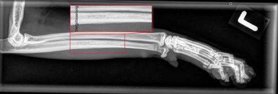 Röntgen nach 4 Wochen