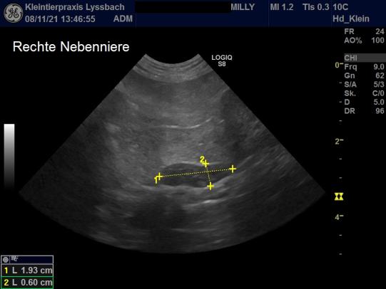 Rechte Nebenniere Milly