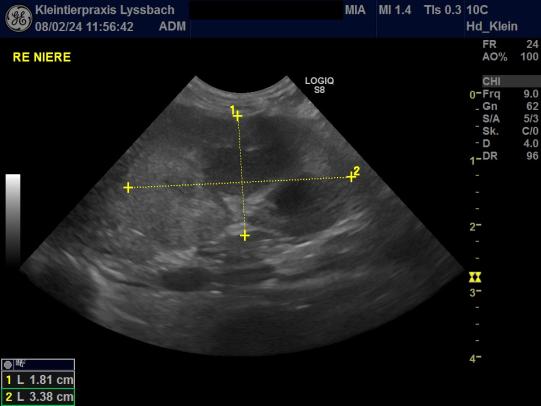 Rechte Niere