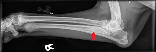Seitenansicht Unterarm rechts