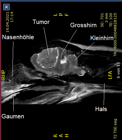 MRT-Aufnahme längs durch den Kopf (sagittale Ebene)